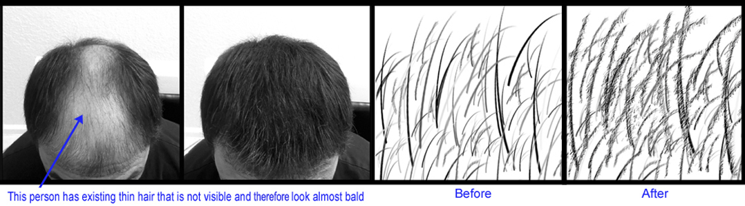 hair building fibers pictures before and after hair building fibers pictures before and after